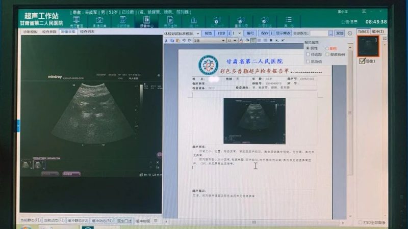 一个完整的全身体检套餐通常包括以下几部分：